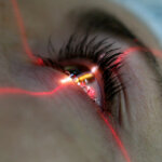 Суть корректировки зрения методом ФРК